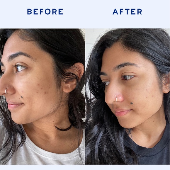 💦 AAVRANI Balance Restoring Serum - Picture 3 of 9